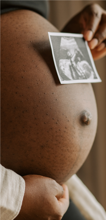 Pregnancy Week-By-Week