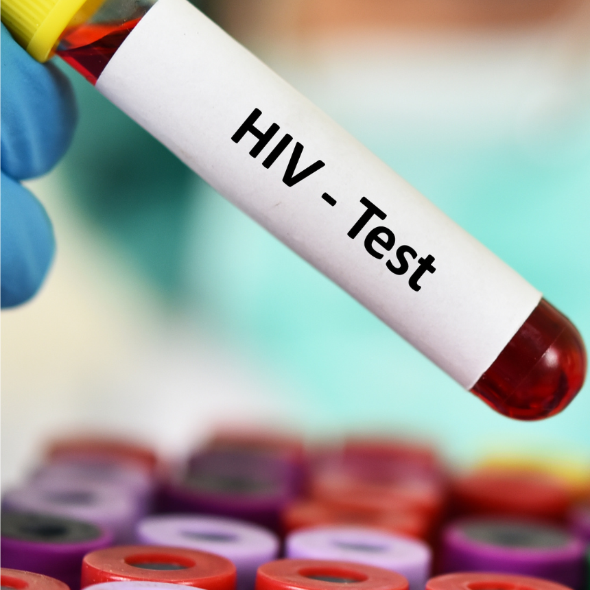 HIV Basics