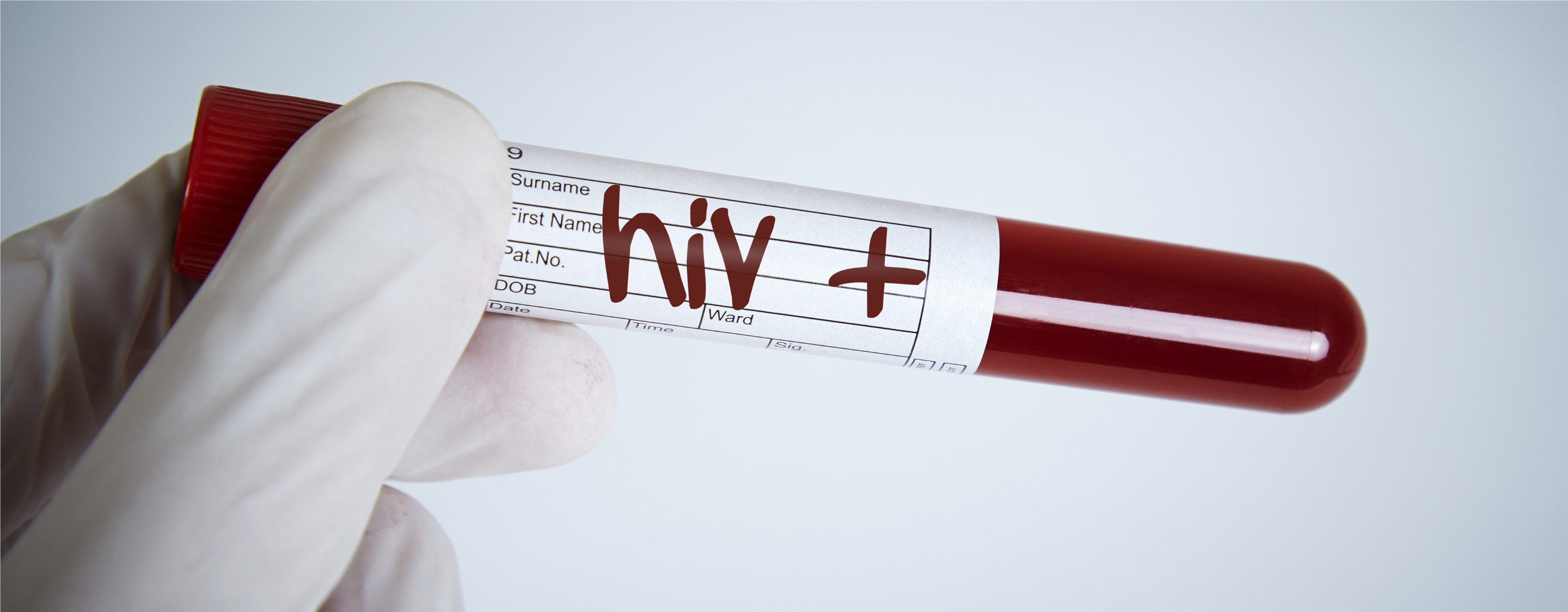 Managing HIV