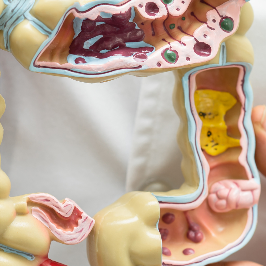 Transform Your Gut Health