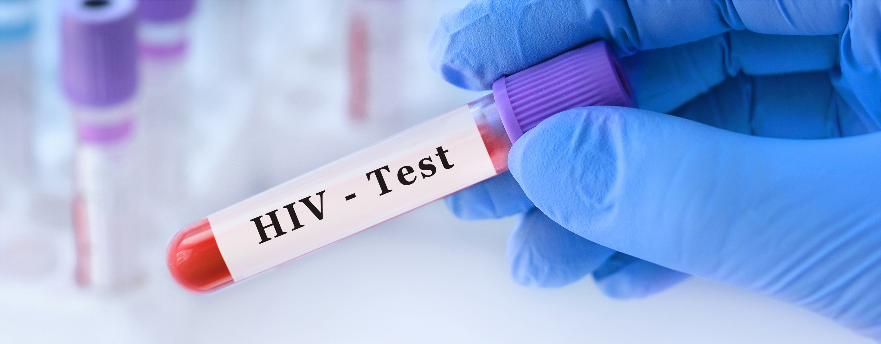 HIV Basics
